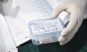 Thành phố Huế hoàn thành sớm lấy mẫu hài cốt liệt sỹ